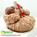 BRAIN07(12404) Life Size Human Anatomical Brain with Arteries - 9 Parts, Anatomy Models > Medical Brain Models